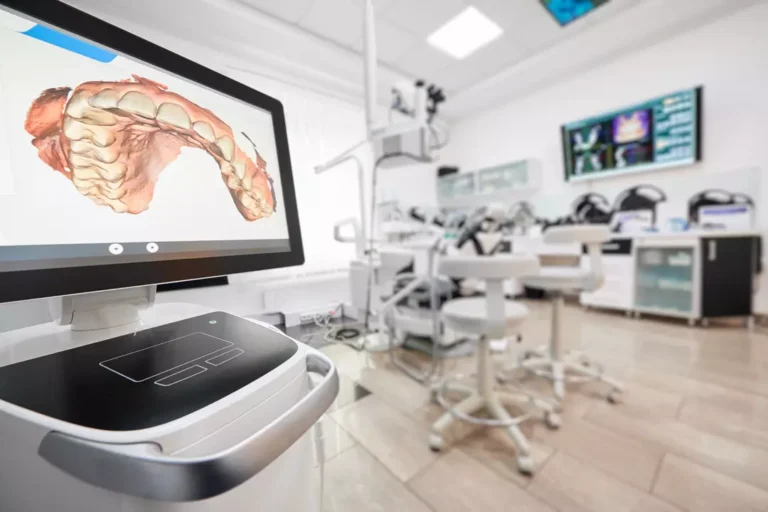 3D Scanning